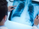 Curso de Radiologia e Imagens